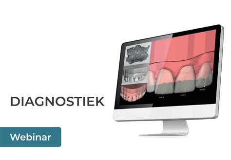 Video On Demand Webinar Diagnostiek NL Elysee Dental NL