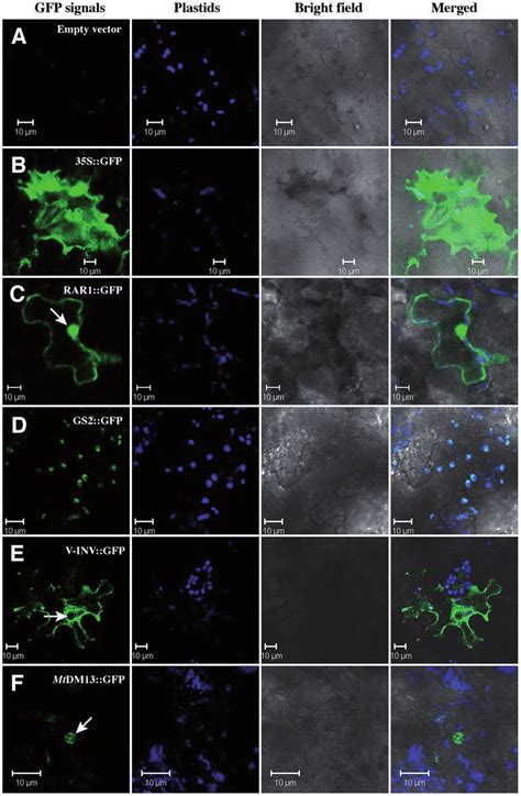 Laser Scanning Confocal Micrographs Showing Gfp Fluorescence From