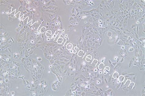 Ovcar 8 人卵巢癌腺癌细胞 原代细胞 Str细胞 细胞培养基 镜像绮点生物