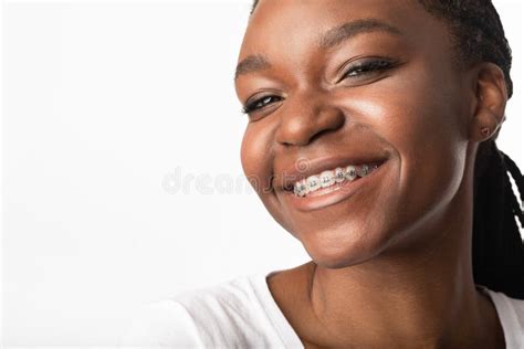 Portrait of Girl in Braces Smiling To Camera, Studio Shot Stock Image ...