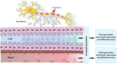 Neurofilament Light Chain As A Biomarker And Correlation With Magnetic