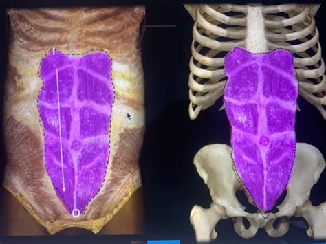 Muscles Acting On The Abdominal Wall Flashcards Quizlet