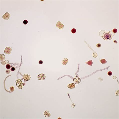 Pollen Tubes, w.m. Microscope Slide | Carolina Biological Supply