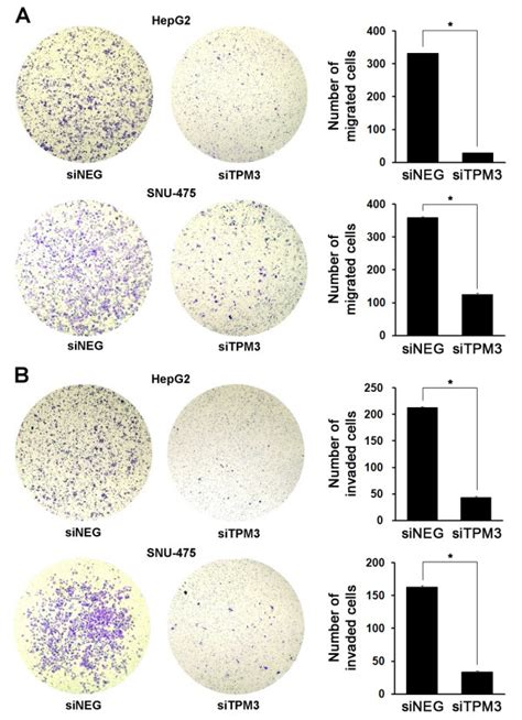 Repressed Migration And Invasion In Tpm3 Knockdown Hcc Cell Lines A