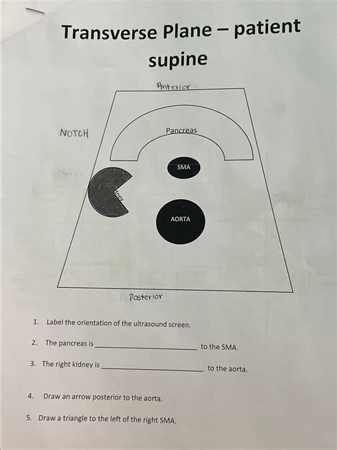 Solved Transverse Plane - ﻿patient supinePosteriorLabel the | Chegg.com