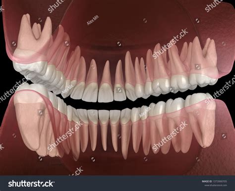 Morphology Mandibular Maxillary Human Gum Teeth