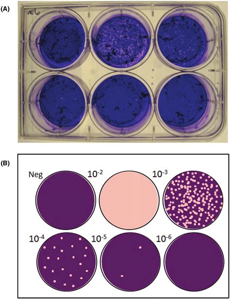 A Representative Plaque Assay Plate Processed By The Alternate