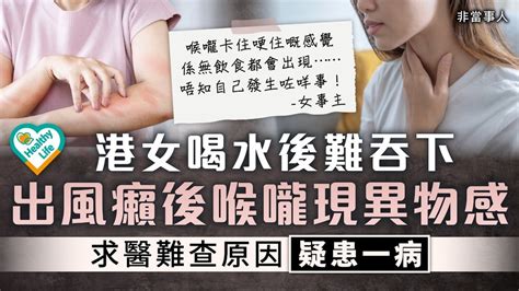 吞嚥困難｜港女喝水後難吞下 出風癩後喉嚨現異物感 求醫難查原因疑患一病 晴報 健康 耳鼻喉專區 D240227