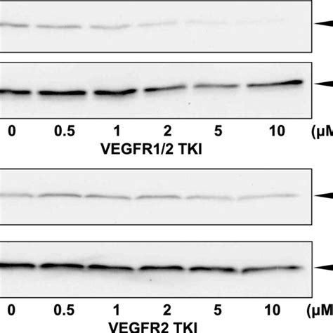 Effects Of Vegfr Tkis On Vegf 165 Induced Akt Phosphorylation After