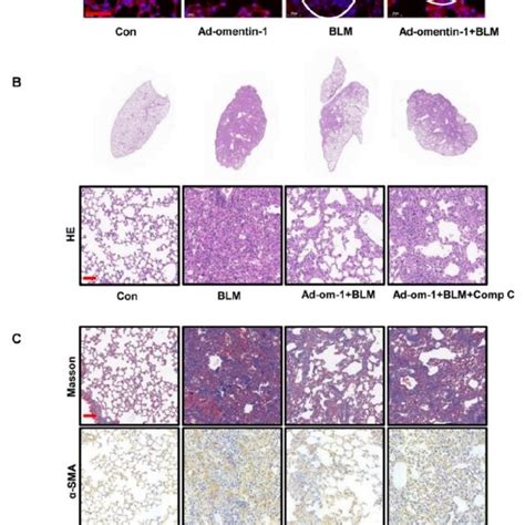 The Effect Of Omentin 1 Mediated By Activation Of AMPK Pathway In Vivo