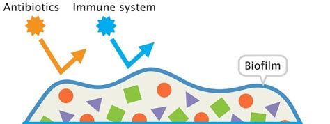 The Good The Bad And The Biofilm Formulae Compounding Pharmacists