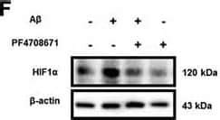 Hif Alpha Antibody H Alpha Nb Novus Biologicals