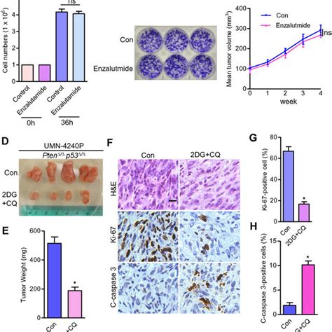 Co Targeting Warburg Effect And Autophagy Suppresses Tumor Growth Of