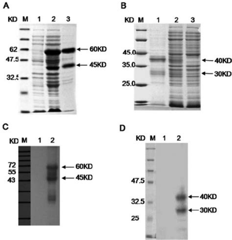 Expression Purification And Western Blot Analysis Of Gst Jgp85 And