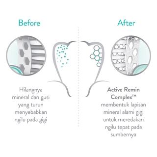 Jual Pepsodent Sensitive Mineral Expert Pasta Gigi Sensitivity