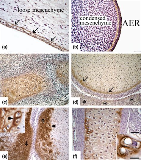 Light Microscopic Localization Of Cartilage Oligomeric Protein Comp