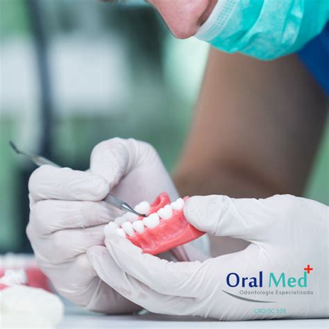 Prótese Protocolo Oralmed Odontologia Especializada