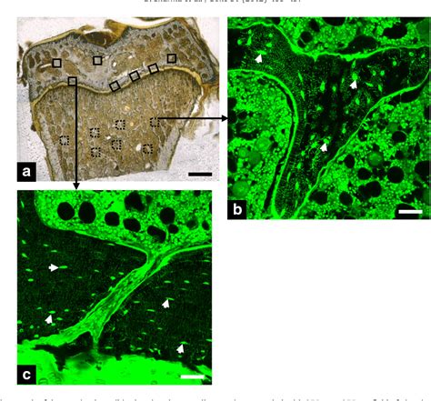 Figure From Alterations In The Osteocyte Lacunar Canalicular