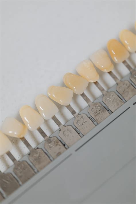 Common Types Of Dental Veneers Findglob