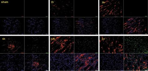 Immunofluorescence Staining For 8 Ohdg Red And Tunel Open I