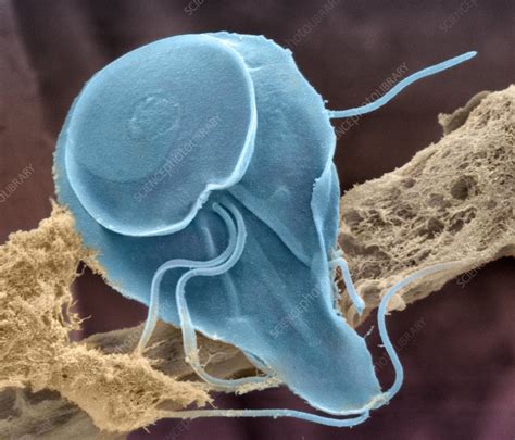 Giardia lamblia protozoan, SEM - Stock Image Z100/0236 - Science Photo ...