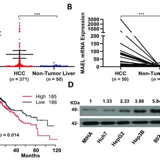 Mael Expression In Hcc Samples And Cell Lines A The Mrna Expression