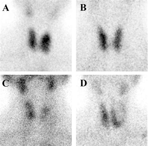 Frontiers Diagnosis Of Thyroid Disease Using Deep Convolutional