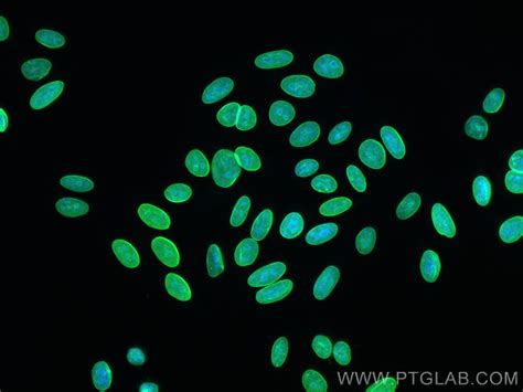 Lamin A C Antibody Rr Proteintech