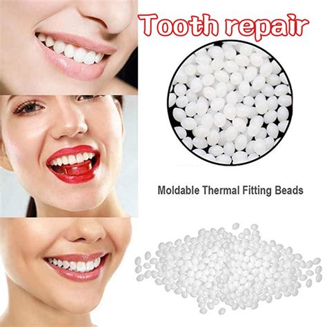 Temporary Tooth Repair Kit Filling Teeth Gaps Moldable False Teeth