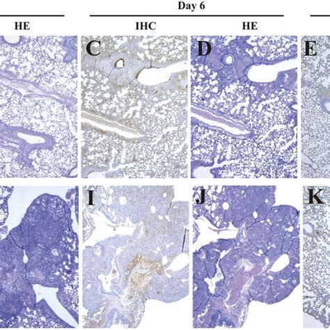 Histopathological Findings In The Lung Of Infected Wild Type Or Ko