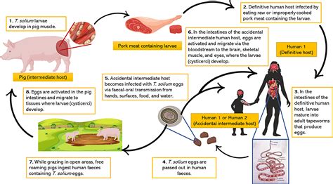 What Causes Seizures In Neurocysticercosis Teresa Julieta Sim Es