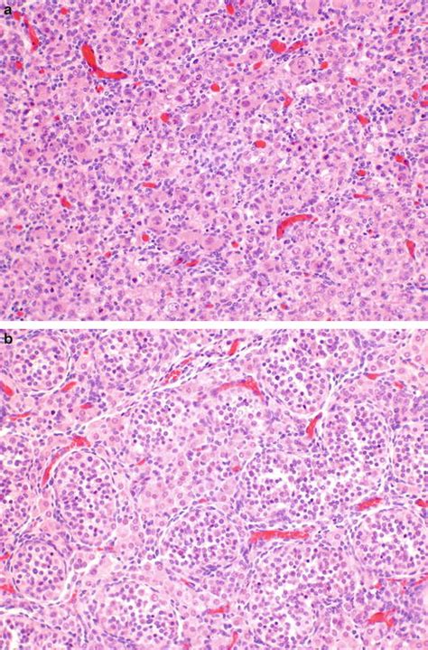Skenes Gland Histology