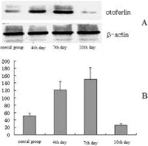 Figure From A Pattern Of Otoferlin Expression Interrupted By