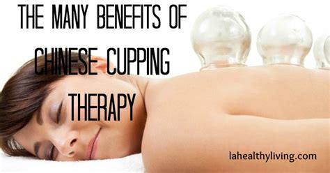 The Many Benefits of Chinese Cupping Therapy