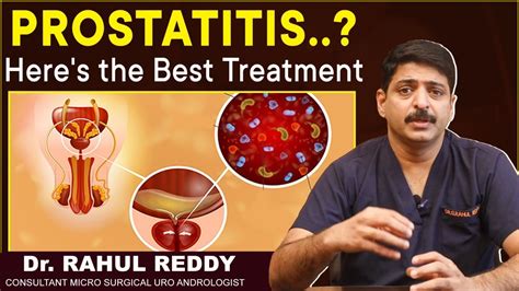 Common Cause Of Prostatitis Treatment Options For Prostatitis Dr