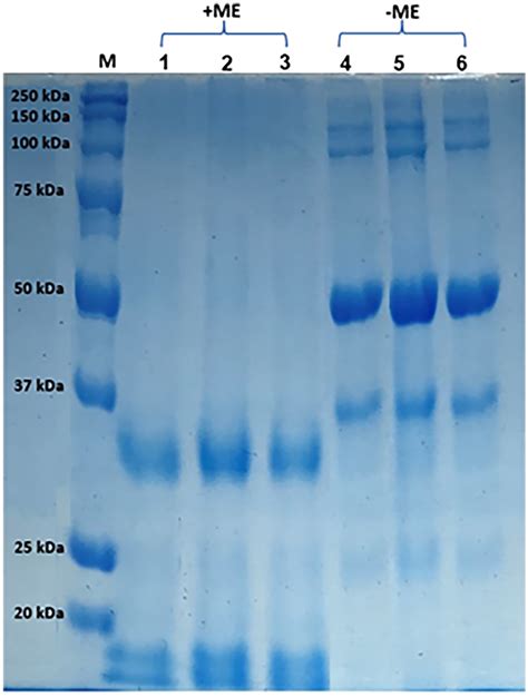 Effect Of Ultrasound On The Sds Page Electrophoretic Profiles Of Orange