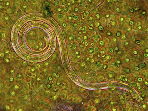 Nematode Among Green Algae Light Micrograph Stock Image C0566045