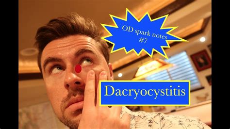 Optometry Spark Notes 7 Dacryocystitis Youtube