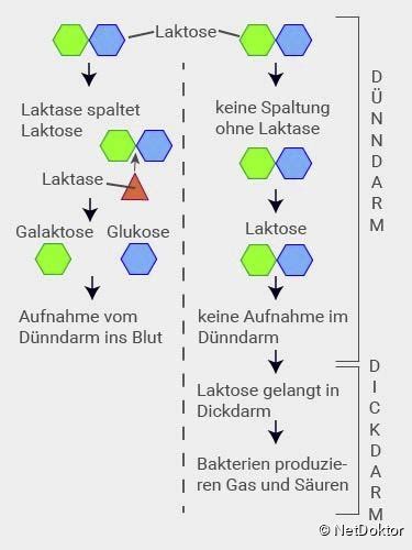 Laktoseintoleranz Ursachen Symptome Behandlung NetDoktor