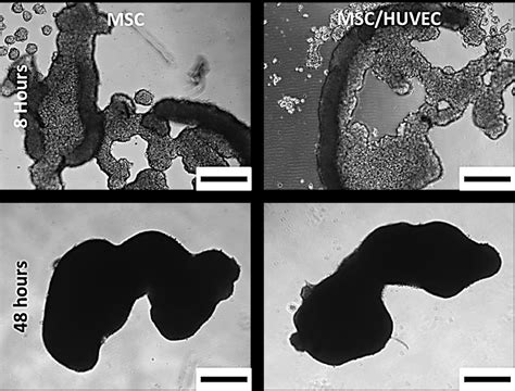 2 Suspension Culture Aggregate Formation Optical Images Showing