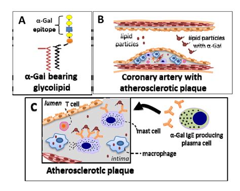 Ige α Gal And Atherosclerosis Figure F1 Aging