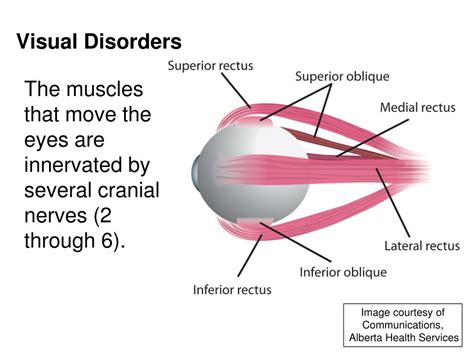 Ppt Practical Considerations Visual Perceptual Disorders Powerpoint