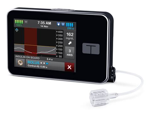 Tandem Closed Loop Cleared for Pediatric Patients | Insulin Nation