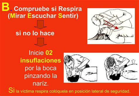 Reanimación cardiopulmonar RCP básico PPT