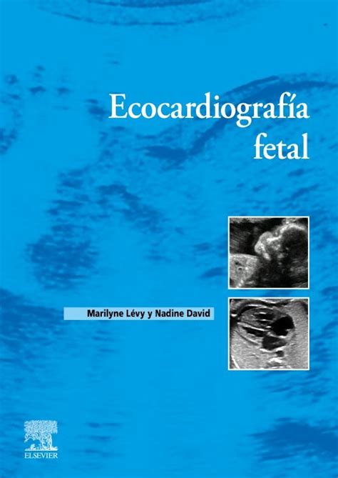 Ecocardiografía fetal en LALEO