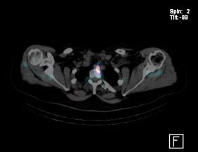 Essentials Of Parathyroid Imaging Operative Techniques In