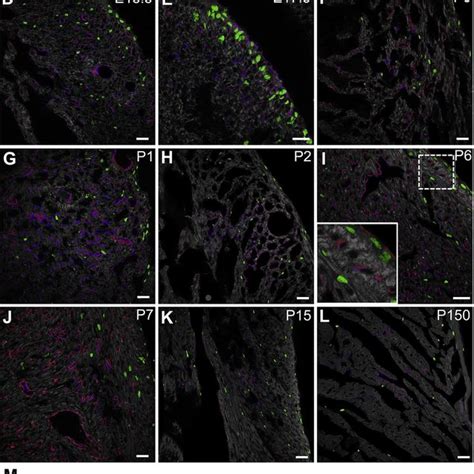 Expression Of Pdgfr And Pdgfr During Normal Heart Development