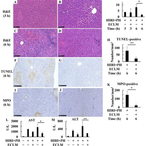 Effects Of Eclm On Pathological Changes In The Liver Of Hiri Ph Treated