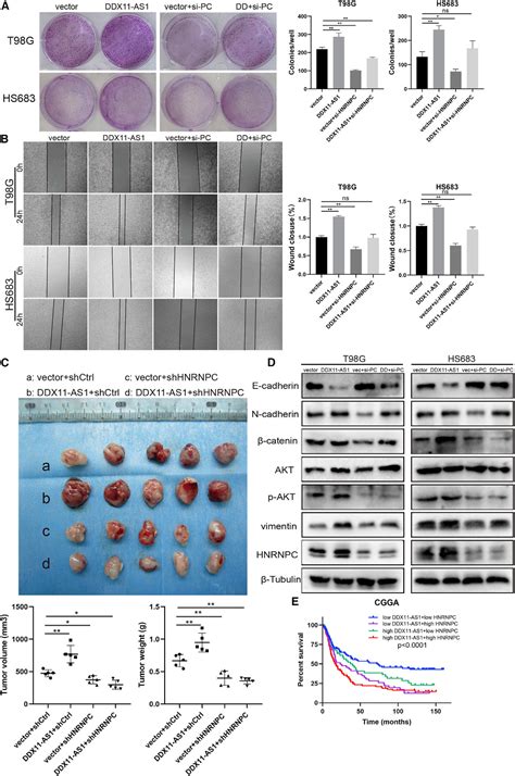 Lncrna Ddx11 As1通过与hnrnpc结合促进胶质瘤细胞的增殖和迁移