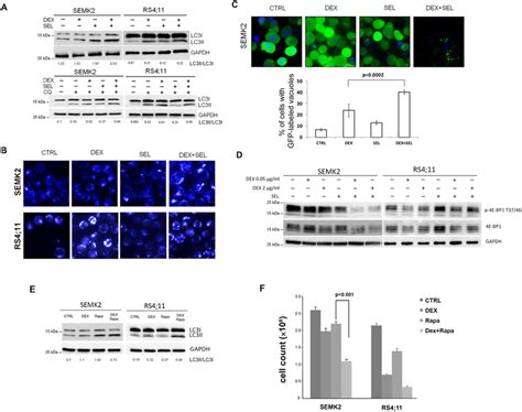 MEK1 2 Inhibitor Selumetinib Intensifies DEX Induced LC3 Conversion